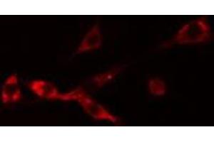 Immunofluorescence (fixed cells) (IF/ICC) image for anti-Neuroblastoma 1, DAN Family BMP Antagonist (NBL1) (C-Term) antibody (ABIN6256865)