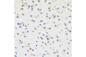 Immunohistochemistry of paraffin-embedded mouse brain using SAFB2 antibody (ABIN5972429) at dilution of 1/100 (40x lens). (SAFB2 antibody)