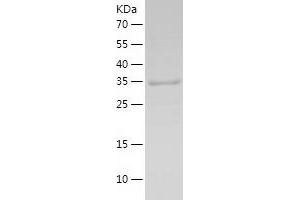 Glutathione Reductase Protein (GSR) (AA 43-522) (His tag)