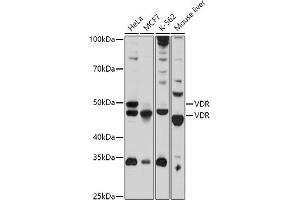 Western blot analysis of extracts of various cell lines, using VDR antibody (ABIN3023180, ABIN3023181, ABIN3023182 and ABIN6219426) at 1:1000 dilution. (Vitamin D Receptor antibody  (AA 1-300))