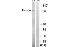 Western blot analysis of extracts from 293 cells, using Bcl-6 (epitope around residue 333) antibody. (BCL6 antibody  (Ser333))