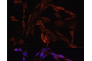 Immunofluorescence analysis of NIH/3T3 cells using OXA1L Polyclonal Antibody at dilution of 1:100.