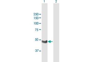 Western Blot analysis of WTIP expression in transfected 293T cell line by WTIP MaxPab polyclonal antibody. (WTIP antibody  (AA 1-430))