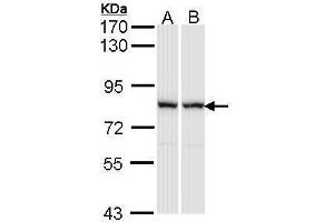 WB Image Sample (30 ug of whole cell lysate) A: A431 , B: Raji 7. (RACGAP1 antibody  (N-Term))