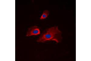 Immunofluorescent analysis of RPS6 (pS235) staining in NIH3T3 cells. (RPS6 antibody  (C-Term, pSer235))