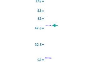 Image no. 1 for Nedd4 Family Interacting Protein 1 (NDFIP1) (AA 1-221) protein (GST tag) (ABIN1312166) (NDFIP1 Protein (AA 1-221) (GST tag))