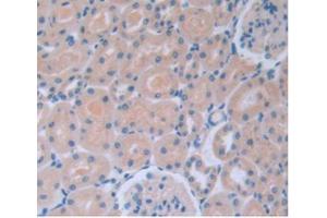 IHC-P analysis of Rat Kidney Tissue, with DAB staining. (IL-6 antibody  (AA 21-211))
