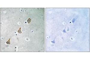 Immunohistochemistry analysis of paraffin-embedded human brain tissue, using PECAM-1 (Ab-713) Antibody. (CD31 antibody  (AA 686-735))