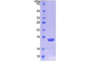 SDS-PAGE analysis of Mouse TREM1 Protein. (TREM1 Protein)