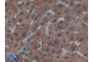 Detection of Cys-C in Human Liver Tissue using Polyclonal Antibody to Cystatin C (Cys-C) (CST3 antibody  (AA 27-146))