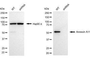 Western blotting analysis using annexin A11 antibody (ABIN7797616). (Annexin A11 antibody)