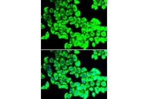 Immunofluorescence analysis of U2OS cells using G3BP1 antibody. (G3BP1 antibody)
