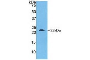 Detection of Recombinant Glucagon, Human using Polyclonal Antibody to Glucagon (GCG) (Glucagon antibody  (AA 23-180))