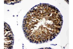 TCP1 theta was detected in paraffin-embedded sections of rat testis tissues using rabbit anti- TCP1 theta Antigen Affinity purified polyclonal antibody (Catalog # ) at 1 µg/mL. (CCT8 antibody  (AA 421-548))