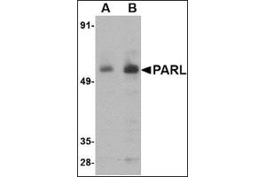 Western blot analysis of PARL in 3T3 cell lysate with this product at (A) 1 and (B) 2 μg/ml.
