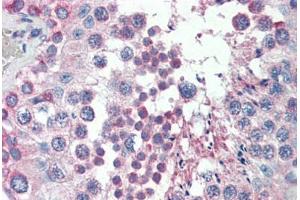 Human Testis (formalin-fixed, paraffin-embedded) stained with MED4 antibody ABIN462248 followed by biotinylated goat anti-rabbit IgG secondary antibody ABIN481713, alkaline phosphatase-streptavidin and chromogen. (MED4 antibody  (AA 146-195))