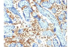Formalin-fixed, paraffin-embedded human Placenta stained with Spectrin alpha 1 (SPTA1) Mouse Monoclonal Antibody (SPTA1/1810). (SPTA1 antibody  (AA 356-475))