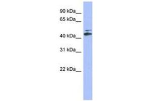 Image no. 1 for anti-Cytochrome P450, Family 20, Subfamily A, Polypeptide 1 (CYP20A1) (AA 35-84) antibody (ABIN6744212) (CYP20A1 antibody  (AA 35-84))