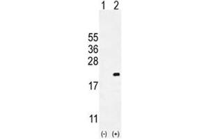 Western blot analysis of CDKN2C antibody and 293 cell lysate either nontransfected (Lane 1) or transiently transfected (2) with the CDKN2C gene.