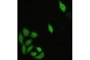 Detection of IRF3 in Hela cells using Polyclonal Antibody to Interferon Regulatory Factor 3 (IRF3) (IRF3 antibody  (AA 1-360))