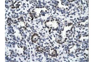 Image no. 1 for anti-RNA Binding Motif Protein 10 (RBM10) (AA 39-88) antibody (ABIN202954) (RBM10 antibody  (AA 39-88))