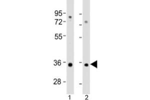 Western blot testing of human 1) A549 and 2) HT-1080 cell lysate with RSPO3 antibody at 1:2000. (R-Spondin 3 antibody  (AA 214-248))
