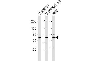 All lanes : Anti-Suz12 Antibody (Center) at 1:2000 dilution Lane 1: mouse spleen lysates Lane 2: mouse cerebellum lysates Lane 3: Hela whole cell lysates Lysates/proteins at 20 μg per lane. (SUZ12 antibody  (AA 381-395))