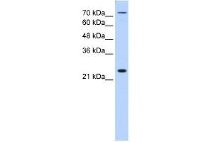 CLDN2 antibody (20R-1258) used at 0. (Claudin 2 antibody  (N-Term))