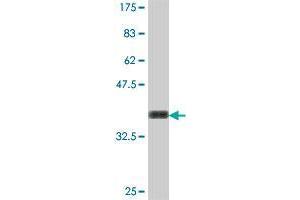 Western Blot detection against Immunogen (36. (IFT122 antibody  (AA 1194-1291))