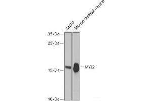 Western blot analysis of extracts of various cell lines using MYL2 Polyclonal Antibody at dilution of 1:3000. (MYL2 antibody)