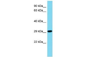 Host: Rabbit Target Name: CDRT15L2 Sample Type: Jurkat Whole Cell lysates Antibody Dilution: 1. (CDRT15L2 antibody  (N-Term))