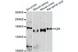 Western blot analysis of extracts of various cell lines, using A2M antibody. (alpha 2 Macroglobulin antibody  (AA 1155-1474))