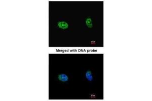 ICC/IF Image Immunofluorescence analysis of paraformaldehyde-fixed HeLa, using S6K2, antibody at 1:100 dilution. (RPS6KB2 antibody  (Center))