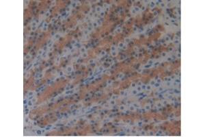 Detection of ARG in Rat Stomach Tissue using Monoclonal Antibody to Arginase (ARG) (ARG antibody  (AA 1-323))