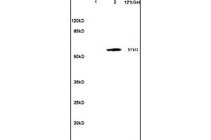 SOAT2 antibody  (AA 331-430)