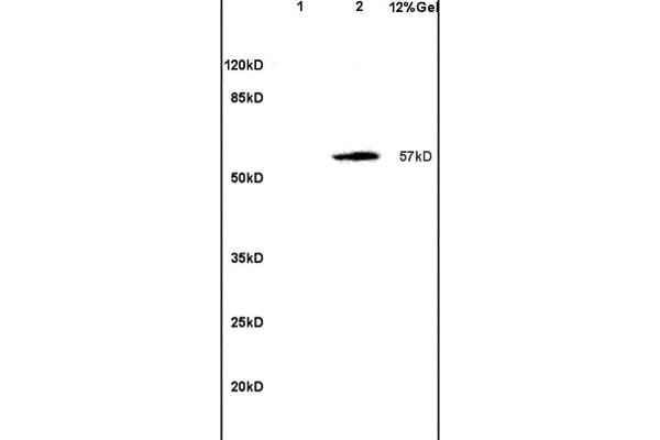 SOAT2 Antikörper  (AA 331-430)