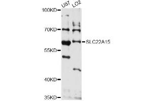 Western blot analysis of extracts of various cell lines, using SLC22A15 antibody (ABIN6293843) at 1:3000 dilution. (SLC22A15 antibody)