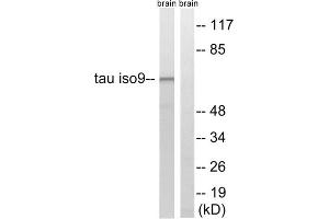 Western blot analysis of extracts from rat brain cells, using Tau (epitope around residue 534/217) antibody. (tau antibody  (Thr217, Thr534))