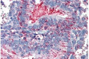 Anti-CDCP1 antibody  ABIN960753 IHC staining of human uterus. (CDCP1 antibody  (Extracellular Domain))