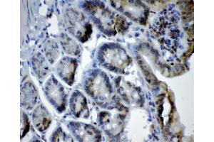 IHC analysis of CRY1 using anti-CRY1 antibody (ABIN3042761).