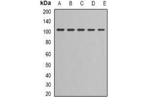 Western blot analysis of DNA Ligase 3 expression in Jurkat (A), NIH3T3 (B), MCF7 (C), PC3 (D), Hela (E) whole cell lysates. (LIG3 antibody)