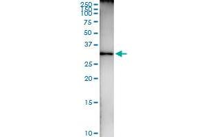 Immunoprecipitation (IP) image for anti-Hydroxyacyl-CoA Dehydrogenase (HADH) (AA 1-314) antibody (ABIN516344)