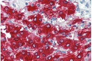Human Adrenal (formalin-fixed, paraffin-embedded) stained with TH antibody ABIN337188 at 5 ug/ml followed by biotinylated goat anti-rabbit IgG secondary antibody ABIN481713, alkaline phosphatase-streptavidin and chromogen. (Tyrosine Hydroxylase antibody  (pSer40))