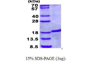 Image no. 1 for Immunity-Related GTPase Family, M (IRGM) protein (His tag) (ABIN1098712)