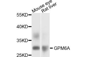Western blot analysis of extract of mouse eye and rat liver cells, using GPM6A antibody. (GPM6A antibody)