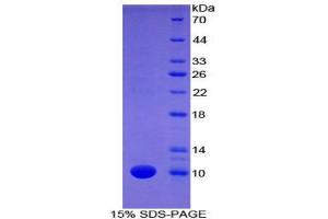 SDS-PAGE (SDS) image for Fibulin 5 (FBLN5) (AA 170-243) protein (His tag) (ABIN2121071)