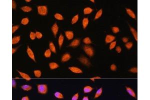 Immunofluorescence analysis of L929 cells using PNPO Polyclonal Antibody at dilution of 1:100. (PNPO antibody)