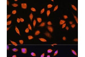 Immunofluorescence analysis of L929 cells using PNPO Polyclonal Antibody at dilution of 1:100.