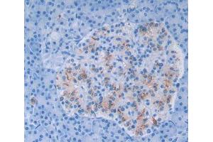 Used in DAB staining on fromalin fixed paraffin- embedded pancreas tissue (GFPT1 antibody  (AA 2-305))