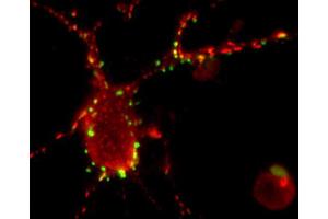 Indirect immunolabeling of cultured hippocampus neurons with anti-Homer 1/2/3 (dilution 1 : 500; red) in combination with anti-Synapsin (cat. (Homer 1/2/3 (N-Term) antibody)